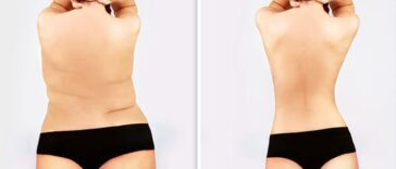 Role of Exercise in a weight loss program 3