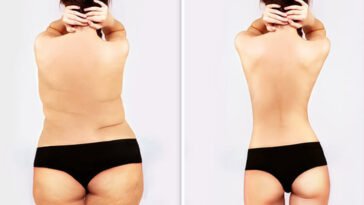 Role of Exercise in a weight loss program 1