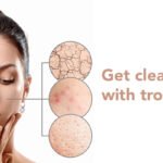 Get Clear skin with scar removal cream