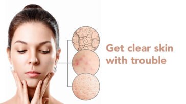 Get Clear skin with scar removal cream