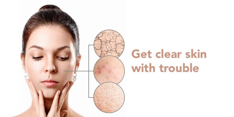 Get Clear Skin with Scar Removal Cream 7 Get Clear skin with scar removal cream