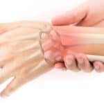 Broken VS Sprained Wrist