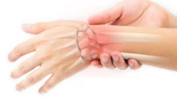 Broken VS Sprained Wrist