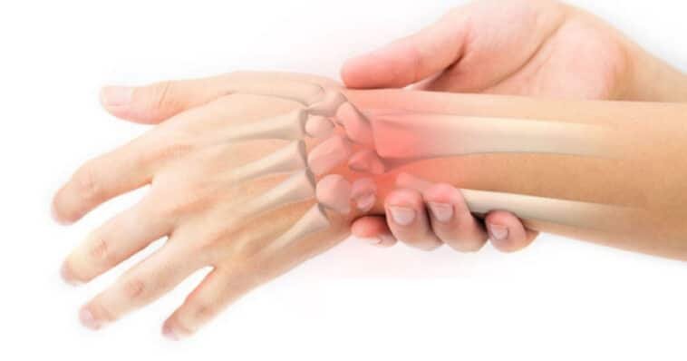 Broken VS Sprained Wrist 7 Broken VS Sprained Wrist