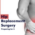 Hip replacement surgery: Preparing for it 34 Hip replacement surgery