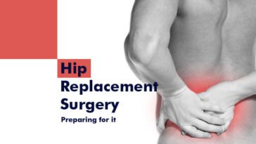 Hip replacement surgery: Preparing for it 12 Hip replacement surgery