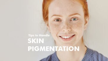 Tips to Handle Skin Pigmentation