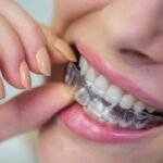 About Using Invisalign as an Adult - Invisalign Treatment
